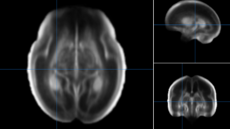 Fetal brain atlas image