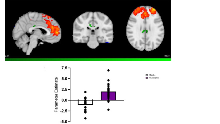 This figure shows that healthy participants who received prucalopride had greater functional connectivity between key cognitive regions (the posterior / anterior cingulate cortices) and a major cognitive network (the central executive network).